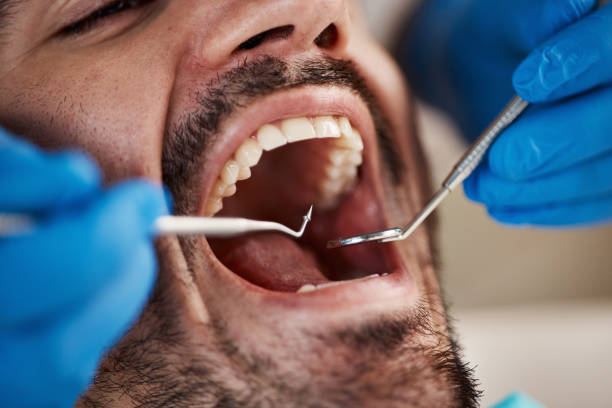 Best Emergency Dental Services for Seniors in Dumas, AR