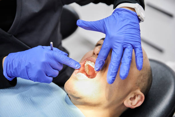 Best Emergency Dentist for Lost Fillings or Crowns in Dumas, AR